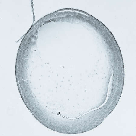science microscopy micrograph cleavage stage of frog eggの写真素材