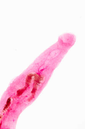 medical microscopy animal parasiteras schistosome blood flukesの写真素材