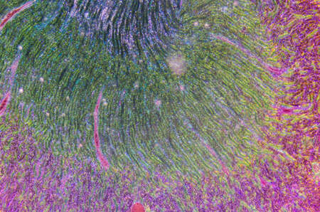 science medical anthropotomy physiology microscopic section of human kidney tissue backgroundの写真素材