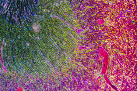 science medical anthropotomy physiology microscopic section of human kidney tissue backgroundの写真素材