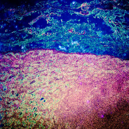 science medical anthropotomy physiology microscopic section of lymph gland tissue backgroundの写真素材
