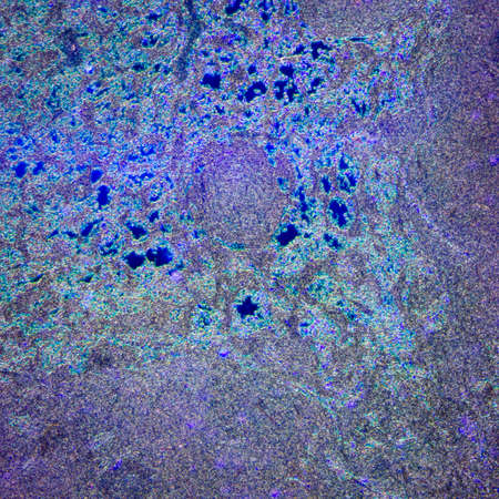 science medical anthropotomy physiology microscopic section of lymph gland tissue backgroundの写真素材