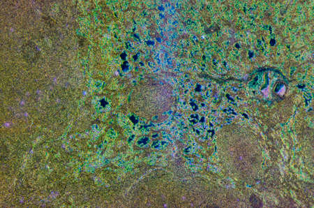 science medical anthropotomy physiology microscopic section of lymph gland tissue backgroundの写真素材