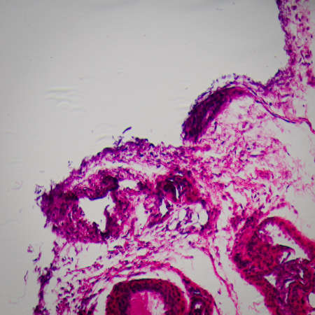 science medical anthropotomy physiology microscopic section of lymph gland tissue backgroundの写真素材