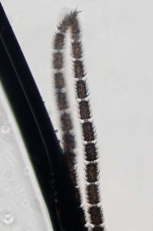 science microscopy micrograph tiny animal insect antennaの写真素材