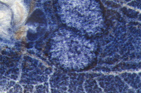science aquaculture fish parasite Benedenia seriolae worm micrographの写真素材