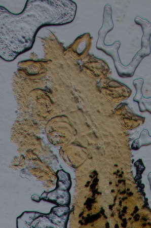 science aquaculture fish parasite  hook clip worm micrographの写真素材