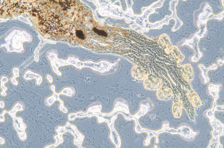 science aquaculture fish parasite  hook clip worm micrographの写真素材