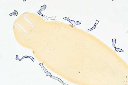 science aquaculture fish parasite Benedenia seriolae worm micrographの写真素材