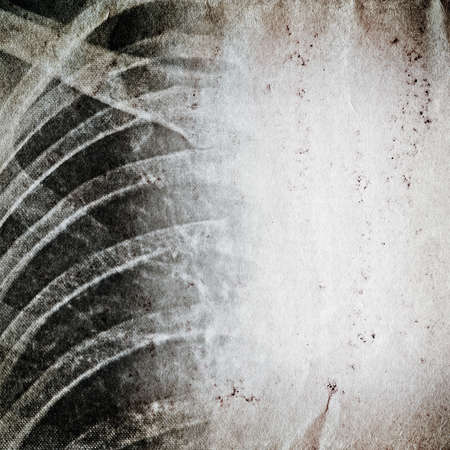x-ray of human chest old grunge paper texture backgroundの写真素材