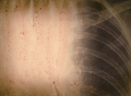 x-ray of human chest old grunge paper texture backgroundの写真素材