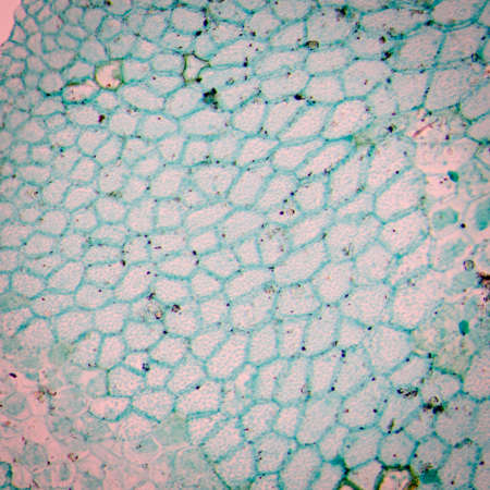 new sporophyte of fern leaf  prothallium, light micrograph, 50X