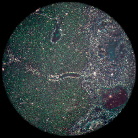 science medical anthropotomy physiology micrograph of liver tissueの写真素材