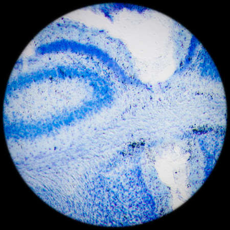 science medical microscopy micrograph, rat brain hippocampal neuronsの写真素材