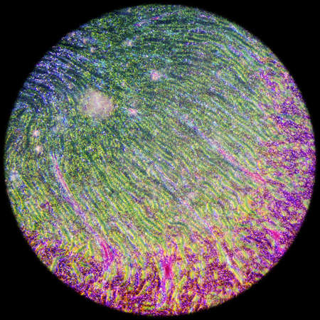 science medical anthropotomy physiology microscopic section of human kidney tissue backgroundの写真素材