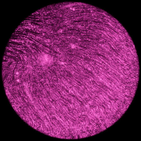 science medical anthropotomy physiology microscopic section of human kidney tissue backgroundの写真素材