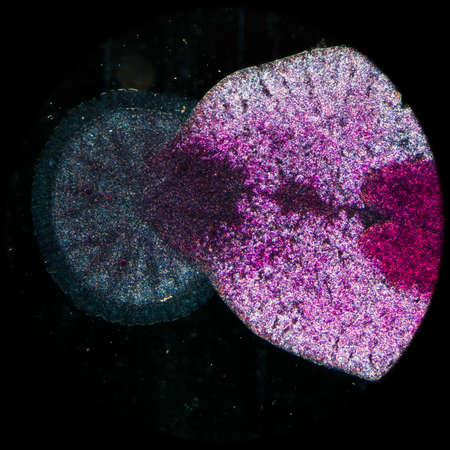 science aquaculture fish parasite Benedenia seriolae worm micrographの写真素材
