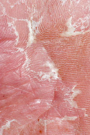 dry skin texture detail of human footの写真素材