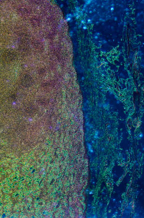 science medical anthropotomy physiology microscopic section of lymph gland tissue backgroundの写真素材