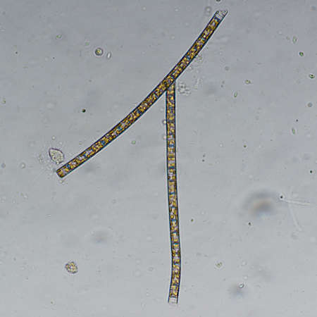 water algae cell macro, micrograph.
