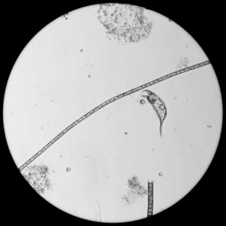 water algae cell macro, micrograph.の写真素材