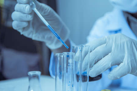 Close up. Medical or male medical in laboratory room research performs tests with blue liquid, Experimental Drug Treatmentの写真素材