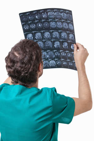 The doctor examines the patient's x-rays on a white backgroundの写真素材