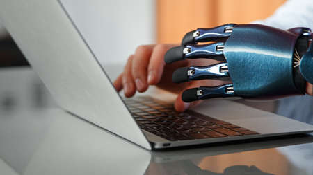 Programmer man hands with artificial bio prothesis type on laptop keyboard on table under bright sunlight in office extreme closeupの写真素材