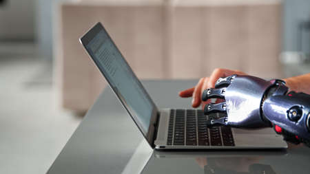 Black bio limb prothesis and healthy hand appear over laptop and type on keyboard under bright sunlight at hacker office close viewの写真素材