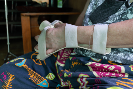 arm splint for treatment