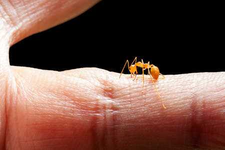 Angry ant biting human skinの写真素材
