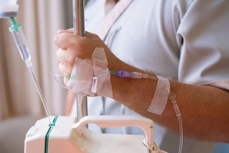 Close-up. Male hand with a dropper during chemotherapy in a hospital. Hand with a dropper. Health is a topic of health and healingの写真素材