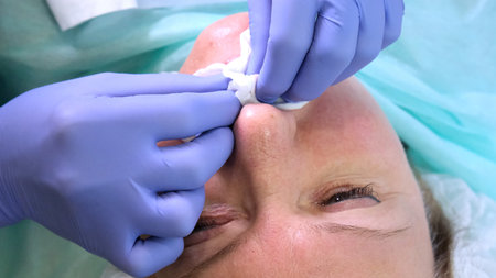 Plastic surgery, the doctor makes a shot in the faceの写真素材
