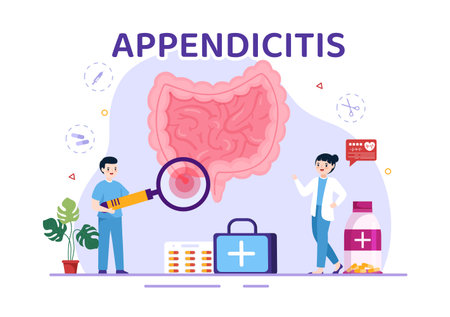 Appendicitis Illustration with Inflammation of the Appendix and Stomach Treatment in Healthcare Flat Cartoon Hand Drawn for Landing Page Templatesのイラスト素材