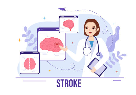 Human Brain Stroke Vector Illustration with Scientific Medical, Hemorrhage and Pain Point in Flat Cartoon Hand Drawn Landing Page Templatesの写真素材
