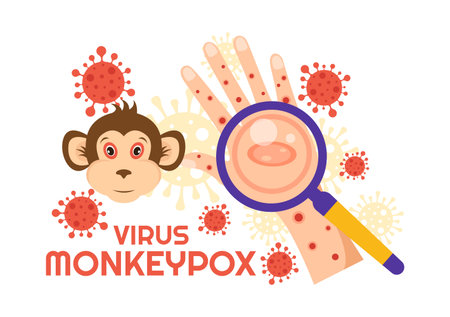 Monkey Pox Outbreak Vector Illustration of Virus Symptoms in Humans Monkeypox Microbiological in Flat Cartoon Hand Drawn Templatesのイラスト素材