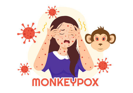 Monkey Pox Outbreak Vector Illustration of Virus Symptoms in Humans Monkeypox Microbiological in Flat Cartoon Hand Drawn Templatesのイラスト素材