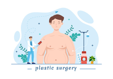 Plastic Surgery Vector Illustration of Medical Surgical Operation on the Body or Face as Expected using Advanced Equipment in Cartoon Backgroundのイラスト素材