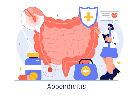 Appendicitis Vector Illustration Featuring Inflammation of the Appendix and Stomach Treatment in a Healthcare Flat Style Cartoon Backgroundのイラスト素材