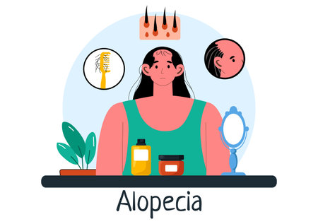 Alopecia Vector Illustration featuring Hair Loss due to Autoimmune Disease and Baldness in a Healthcare Theme with a Flat Style Cartoon Backgroundのイラスト素材