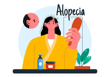 Alopecia Vector Illustration featuring Hair Loss due to Autoimmune Disease and Baldness in a Healthcare Theme with a Flat Style Cartoon Backgroundのイラスト素材