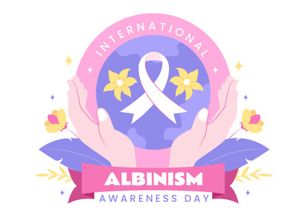 International Albinism Awareness Day Vector Illustration on June 13, Featuring People with a Rare Genetic Disorder Advocating for Human Rightsのイラスト素材