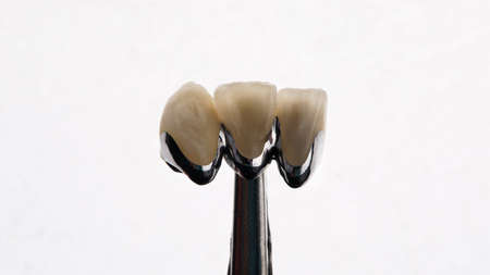 Composition Dental Crowns made of metal ceramics on a white background
