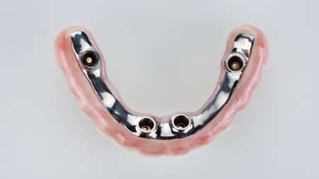 Titanium beam in dental prosthesis from zircon, top view on white background