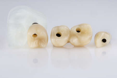 Temporary dental crowns chewing teeth on a white background