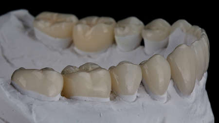 Lower jaw model with high quality ceramic crowns on black backgroundの写真素材