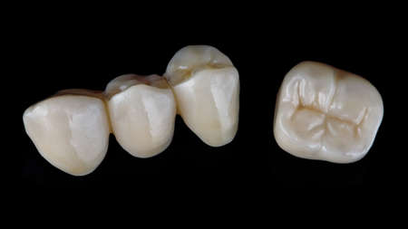 aesthetics of dental crowns made of zircon, top view on a black backgroundの写真素材