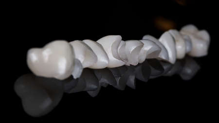 beautiful row of dental veneers in perspective and blurred backgroundの写真素材