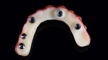 the upper part of a budget prosthesis on a black backgroundの写真素材