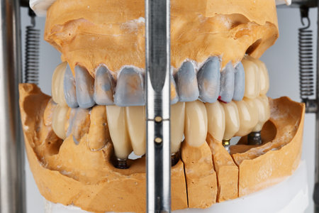 dental bridges and crowns in occlusion on models in the articulator